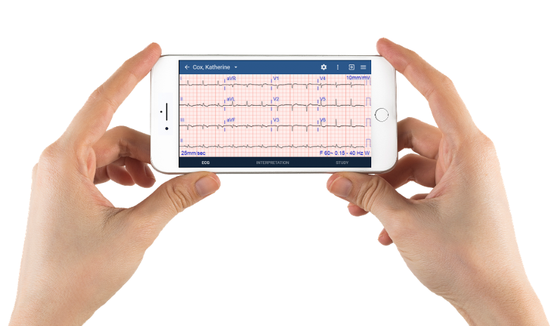ECG Workflow Challenge Resolved with Cardio Server on an iPhone from Church